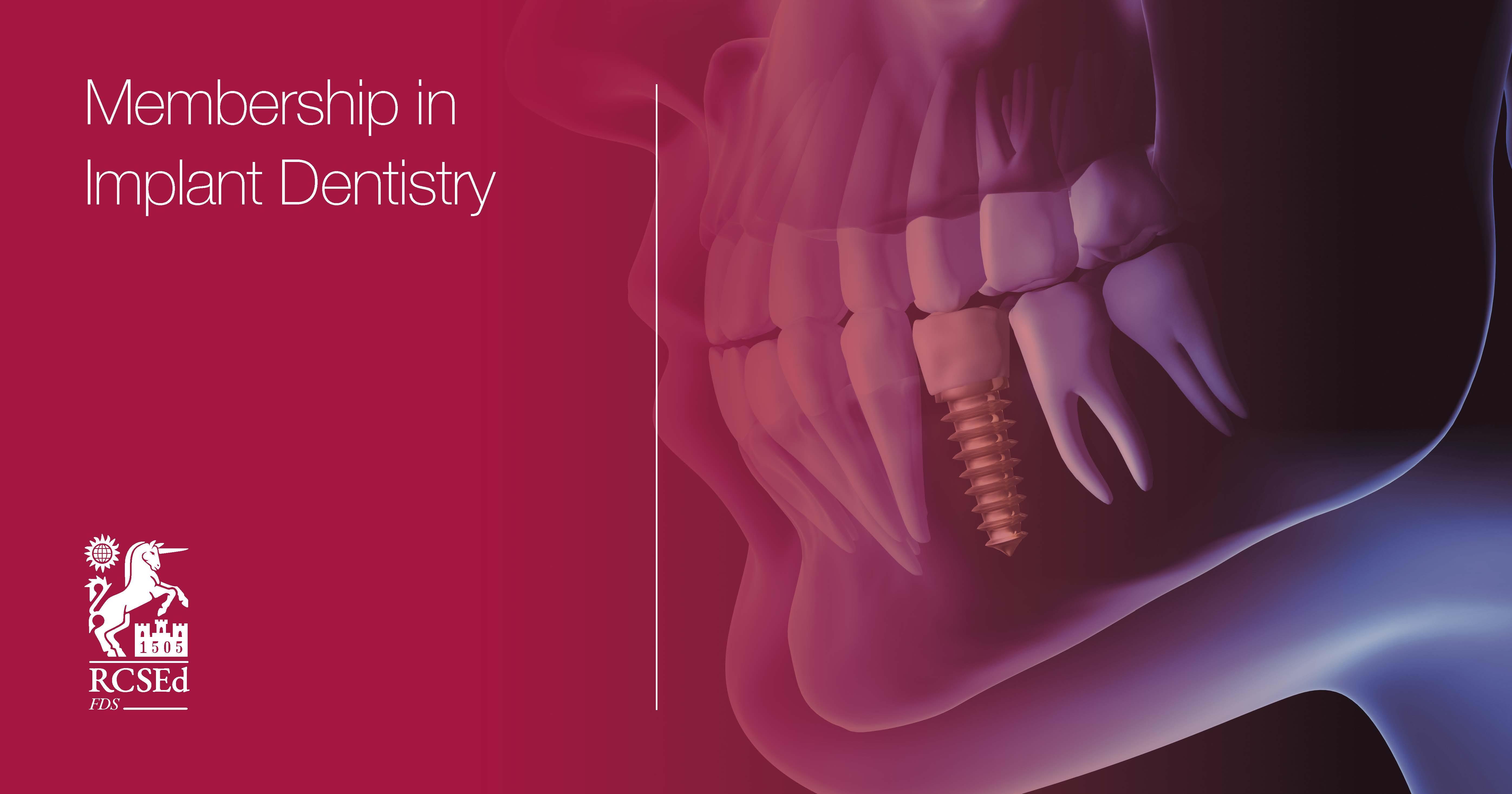 Membership in Implant Dentistry