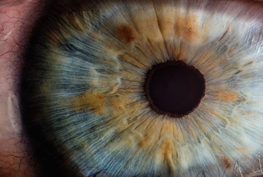 RCSEd Launches New MRCS Ophthalmology Examinations  - Read more