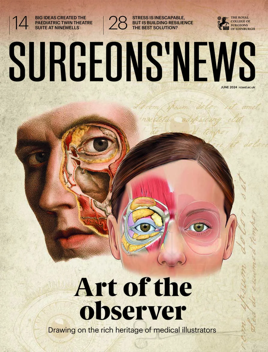 Surgeons' News - June 2024 - Art of observer