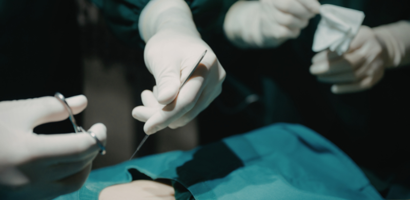 True Cut: Making Sense of Mistakes